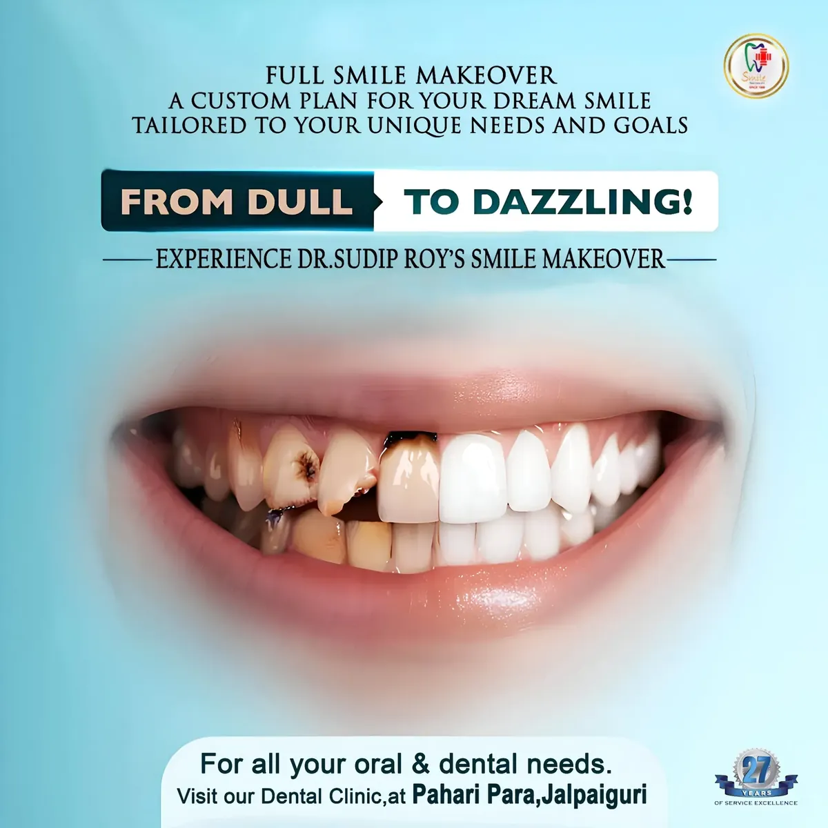 Smile makeover without braces Jalpaiguri