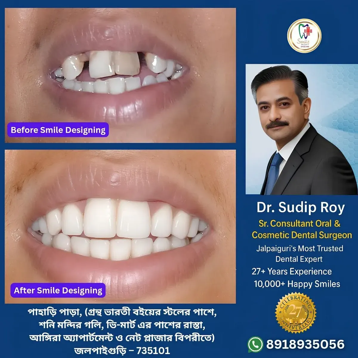 Cosmetic dentist Jalpaiguri – digital dentistry